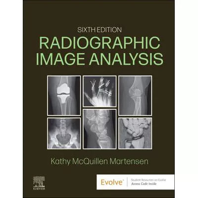 Radiographic Image Analysis - E-Book : Radiographic Image Analysis - E-Book